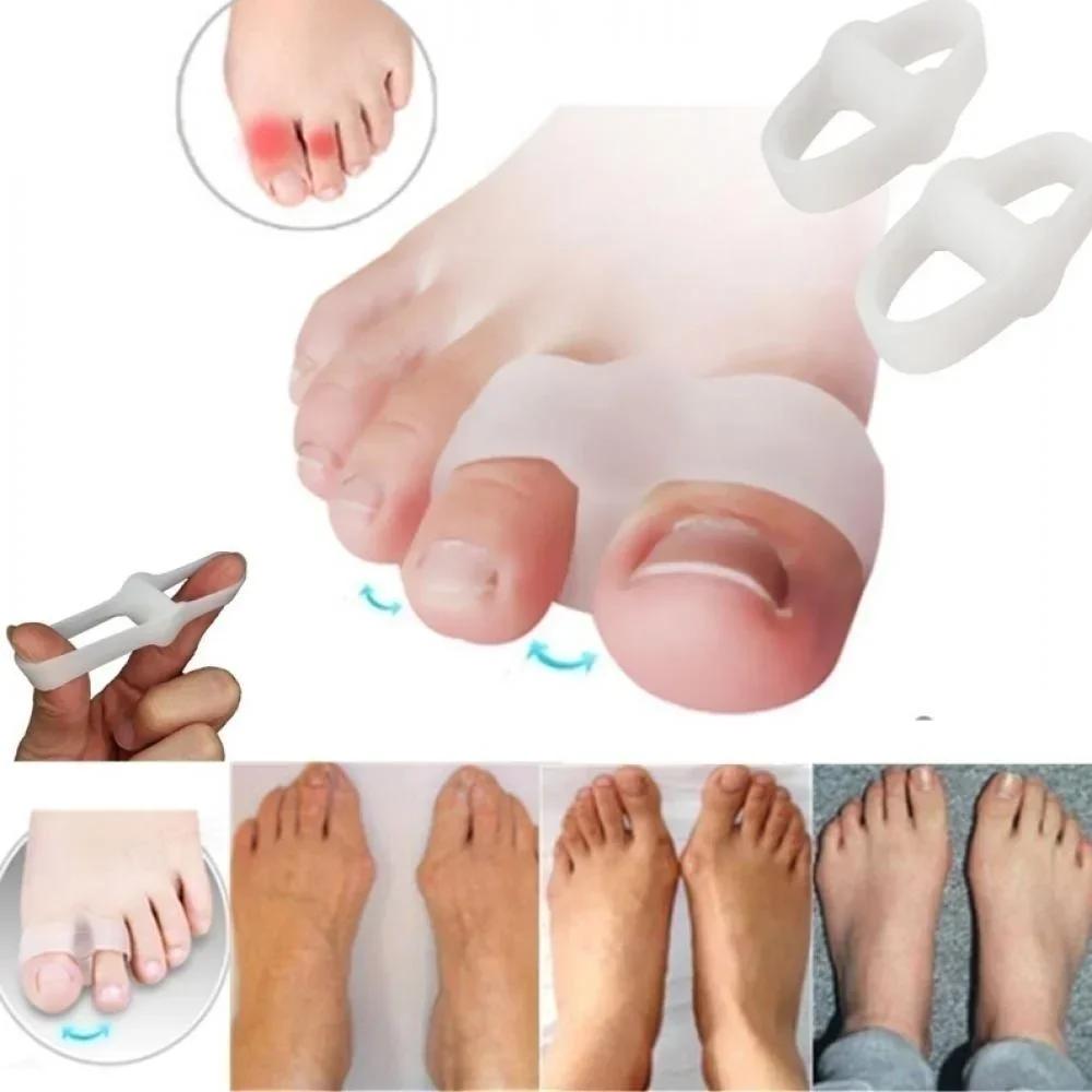 Correction Fluid White - 2 Holes Bunion Corrector Pain Relief